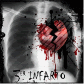 3er infarto Pictures, Images and Photos