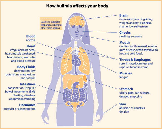 effects-of-eating-disorders